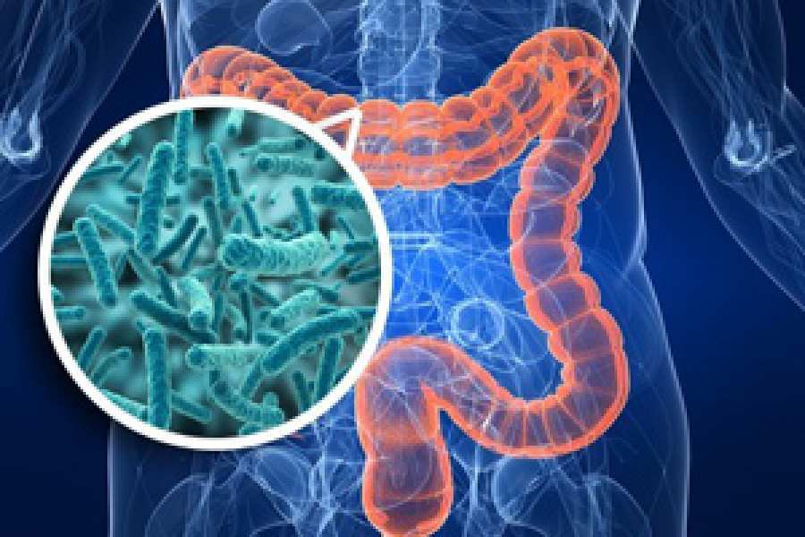 Un probiótico reduce la inflamación y suprime tumores de colon