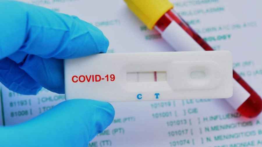 Anmat autorizaría los test de autodiagnóstico de Covid-19