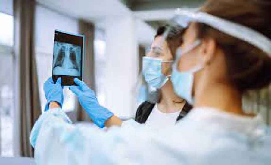 Aumentaron las muertes por tuberculosis durante la pandemia