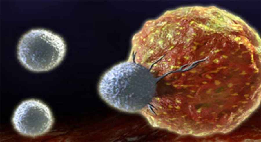 Un f&aacute;rmaco de 70 a&ntilde;os ayuda a frenar la progresi&oacute;n del c&aacute;ncer de mama