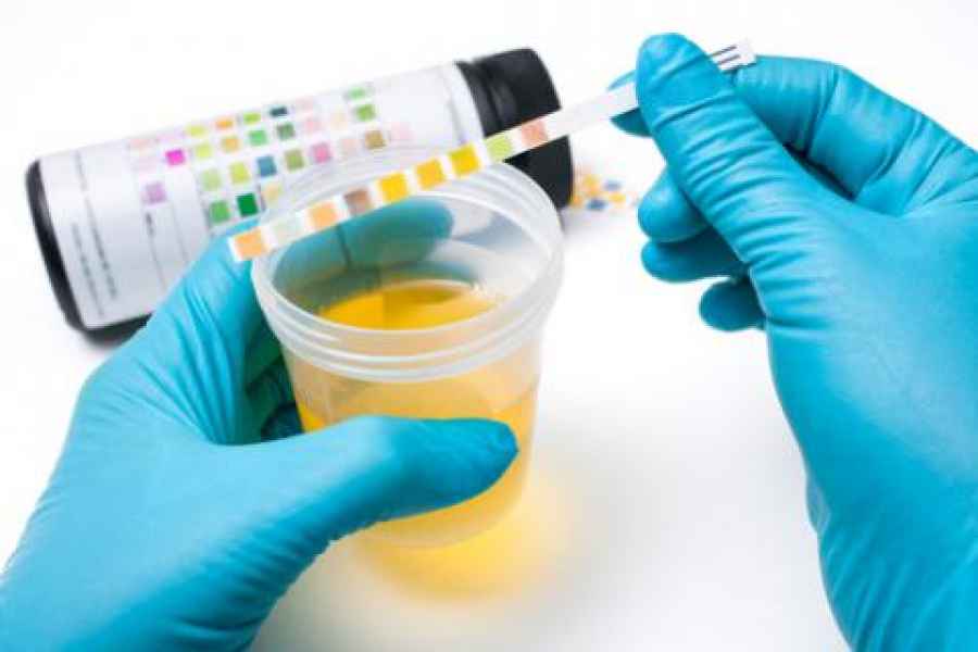 Argentina: 10 casos diarios de cáncer de vejiga