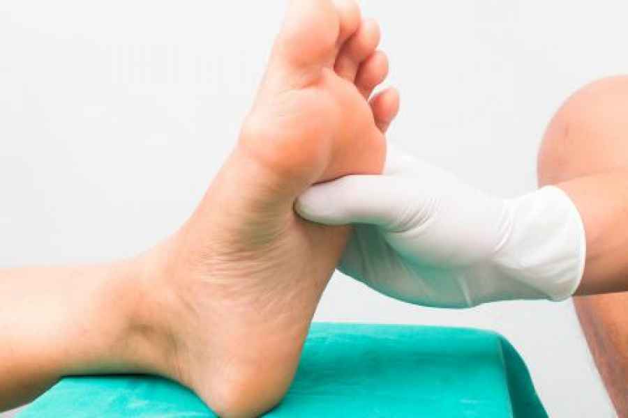 El pie diabético es una de las causas principales de morbimortalidad entre pacientes afectados por la diabetes mellitus.