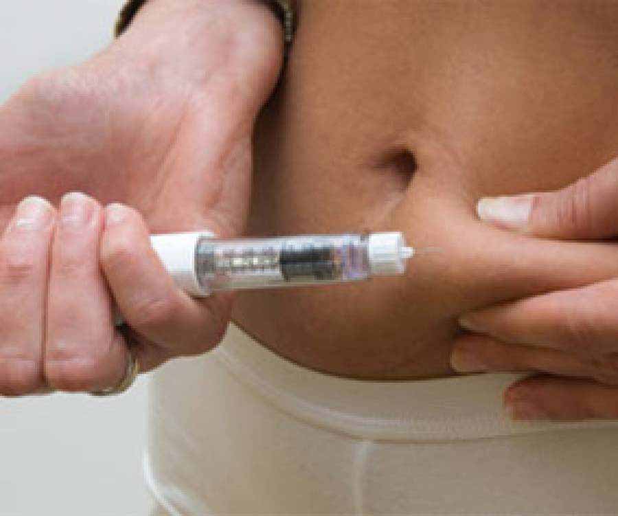 Exenatida, potencial terapia frente al parkinson