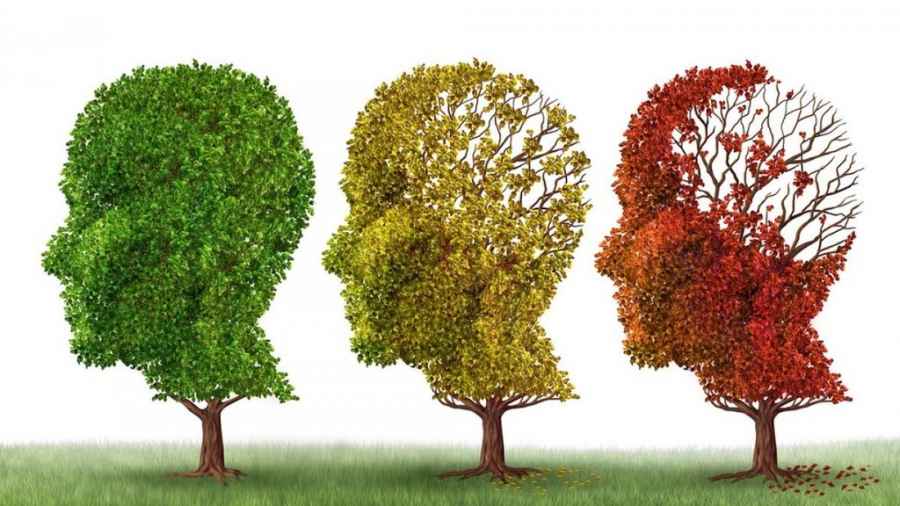 Nuevo tratamiento farmacológico en Alzheimer
