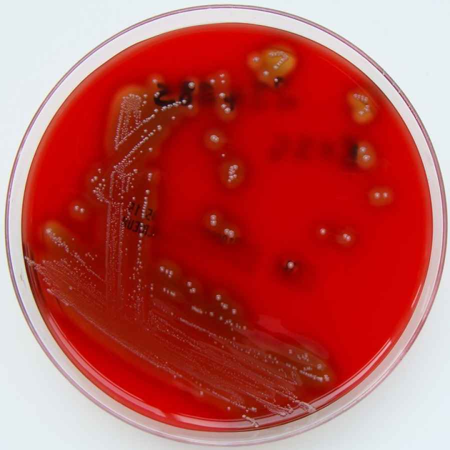 Streptococcus pyogenes. Una imagen de la bacteria que afectó a cinco chicos