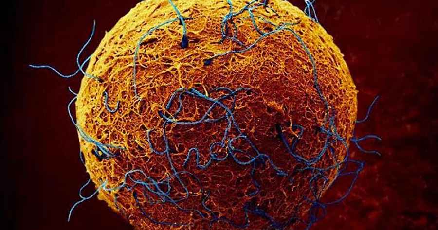 La melatonina puede ayudar a aumentar el éxito de los transplantes de médula