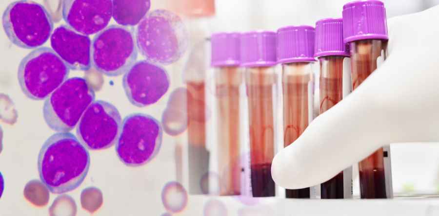 Se diagnostican en Argentina m&aacute;s de 50 leucemias por semana