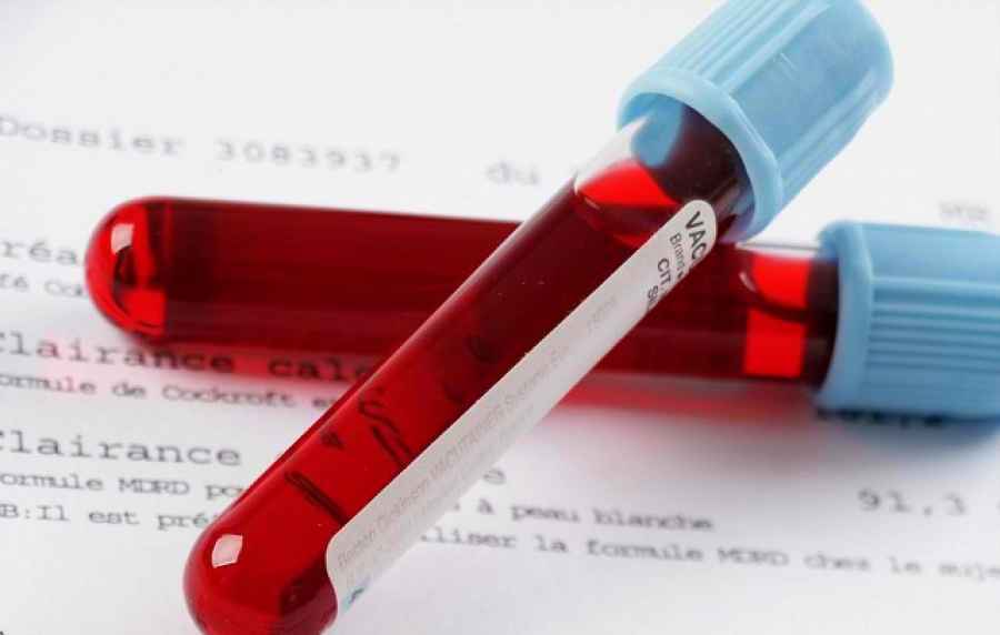 DESCUBREN UN BIOMARCADOR QUE DETECTA EL DENGUE HEMORR&Aacute;GICO