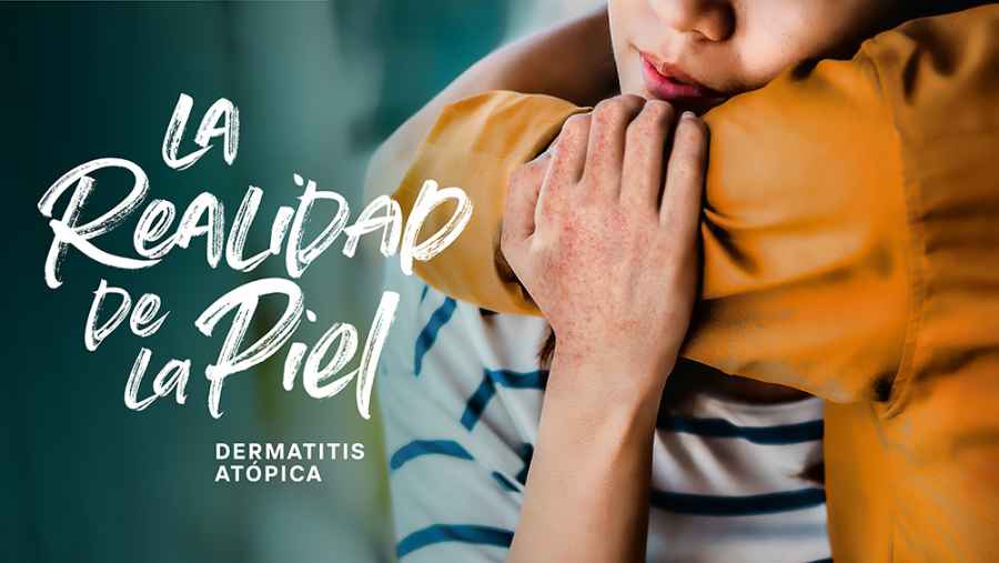 Pfizer Argentina lanzó la campaña “La realidad de la piel”